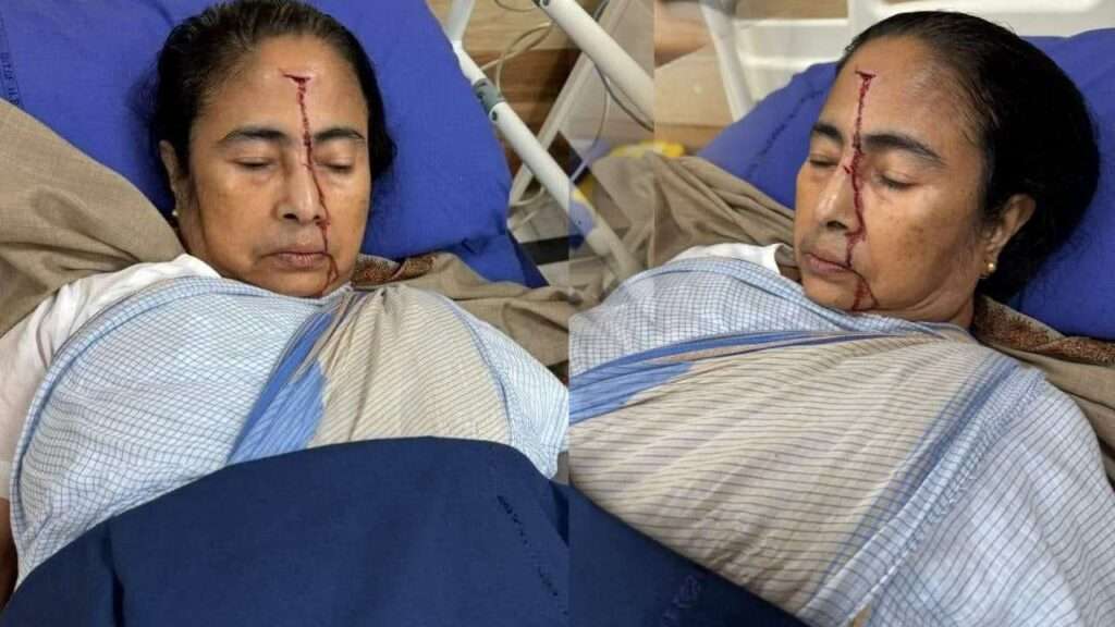 mamata banerjee injured